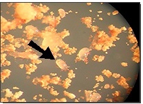 Stereomikroskopische Aufnahme der Milben 