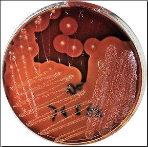 Abb. 6: Clostridium perfringens auf Clostridium Selektiv Agar (CSA)