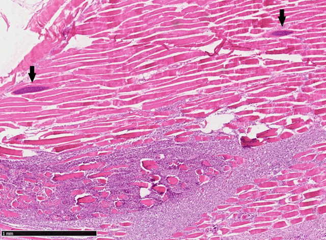 Abbildung 3: Reh. Histologische Untersuchung der Muskelfleischprobe: Nahansicht Skelettmuskulatur mit Entz�ndung und Sarkosporidienzysten (Pfeile)