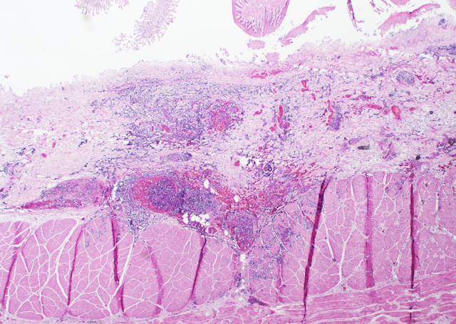 Bild 4: Tiefreichende Entz�ndung des Pansenschleimhaut mit Entz�ndung der Blutgef��e, HE-F�rbung, 20fache Vergr��erung